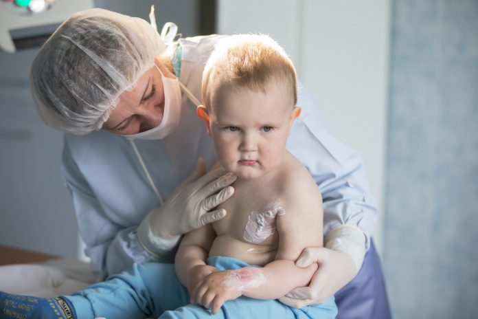 Làm khi khi trẻ bị bỏng