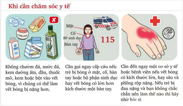 Các trường hợp bé cần đến cơ sở y tế khi bị bỏng
